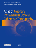 Atlas of Coronary Intravascular Optical Coherence Tomography - Annapoorna Kini, Jagat Narula, Yuliya Vengrenyuk & Samin Sharma