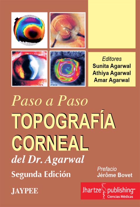 TOPOGRAFÍA CORNEAL. Paso a paso.