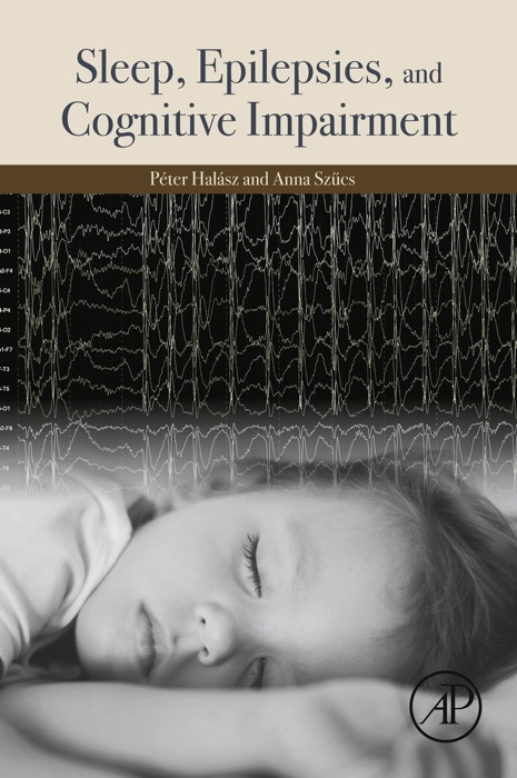 Sleep, Epilepsies, and Cognitive Impairment