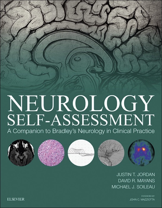 Neurology Self-Assessment: A Companion to Bradley's Neurology in Clinical Practice E-Book