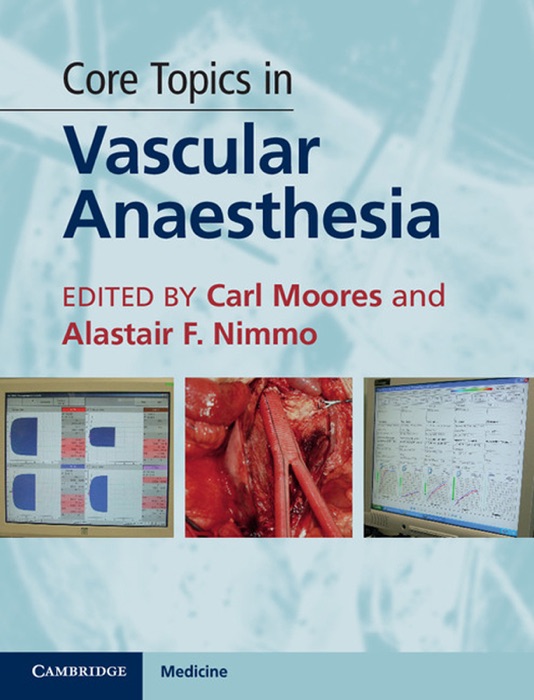 Core Topics in Vascular Anaesthesia