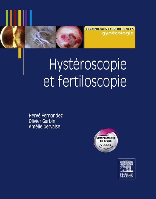 Hystéroscopie et fertiloscopie