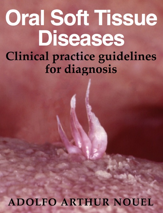 Oral Soft Tissue Diseases. Clinical practice guidelines for diagnosis