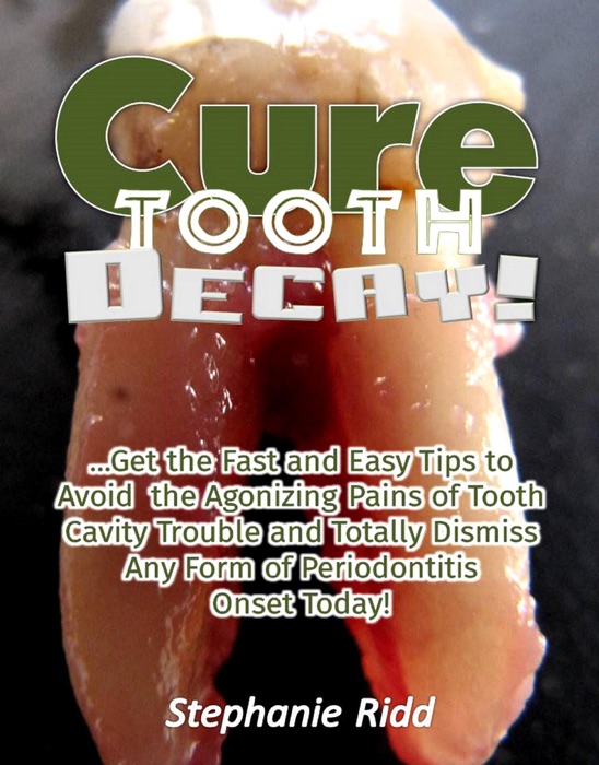 Cure Tooth Decay! : Get the Fast and Easy Tips to Avoid the Agonizing Pains of Tooth Cavity Trouble and Totally Dismiss Any Form of Periodontitis Onset Today!