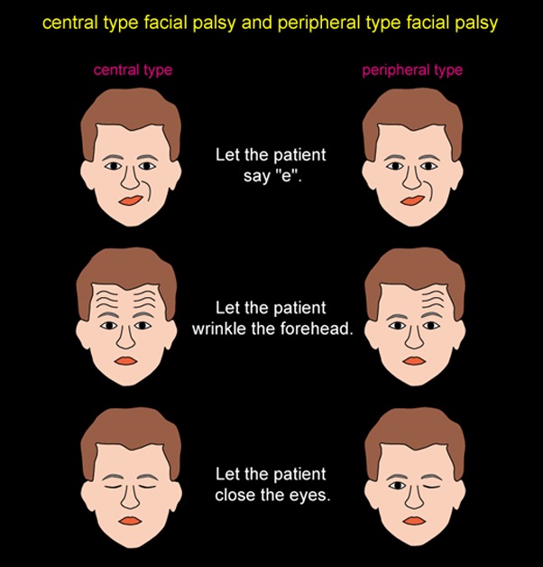 Neurology note