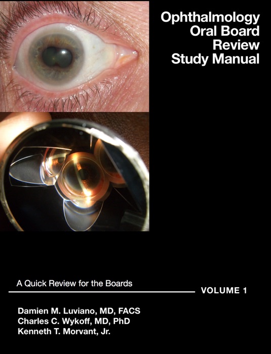 Ophthalmology Oral Review Study Manual: