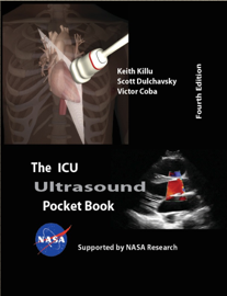 The ICU Ultrasound Pocket Book