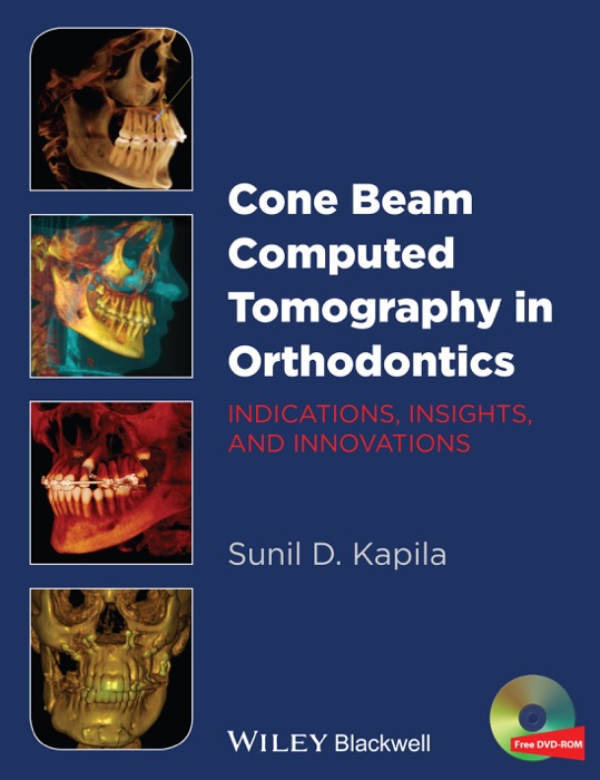 Cone Beam Computed Tomography in Orthodontics