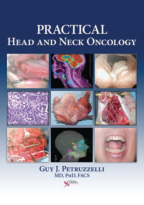 Practical Head and Neck Oncology