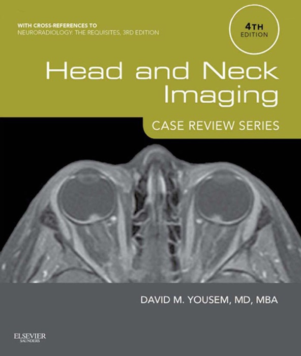 Head and Neck Imaging