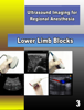 A Practical Guide to Ultrasound Imaging for Regional Anesthesia : Part 3 - Lower Limb Blocks - Vincent WS Chan