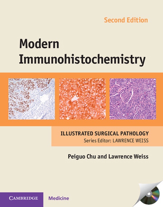 Modern Immunohistochemistry: Second Edition