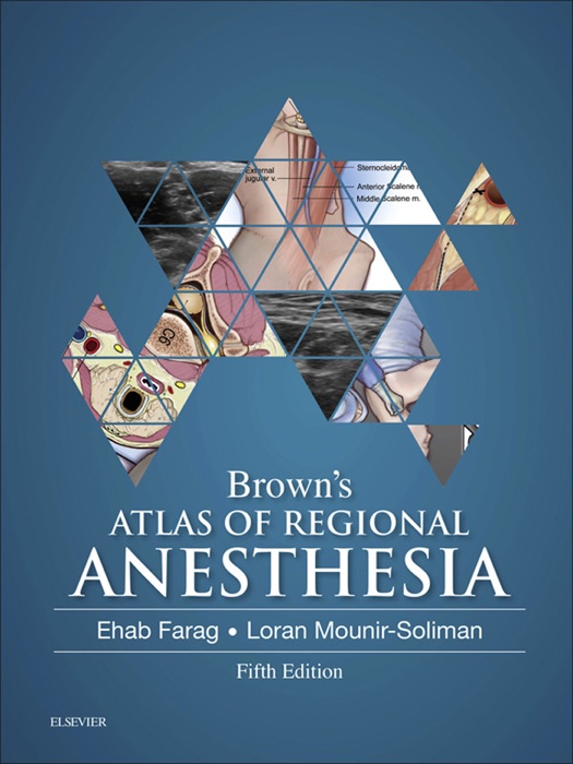 Brown's Atlas of Regional Anesthesia eBook