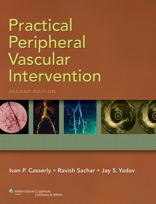 Practical Peripheral Vascular Intervention: Second Edition