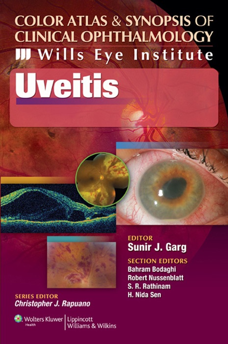 Wills Eye Institute - Uveitis