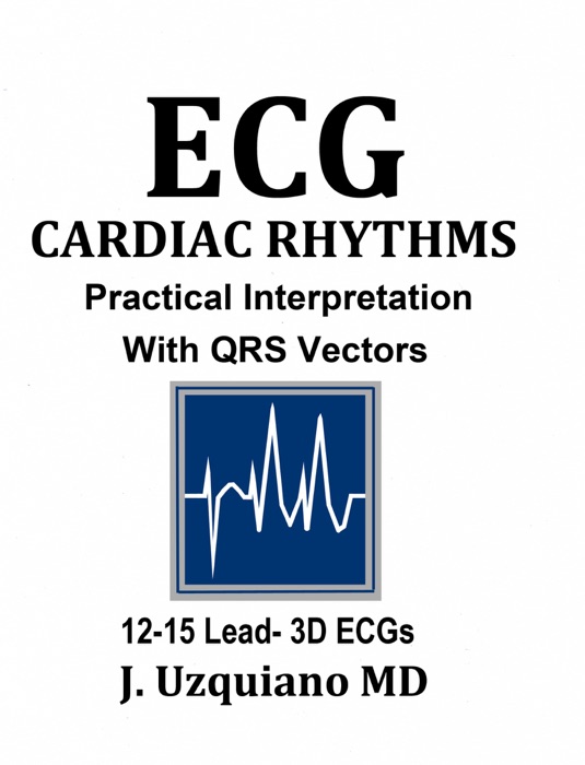 ECG Cardiac Rhythm