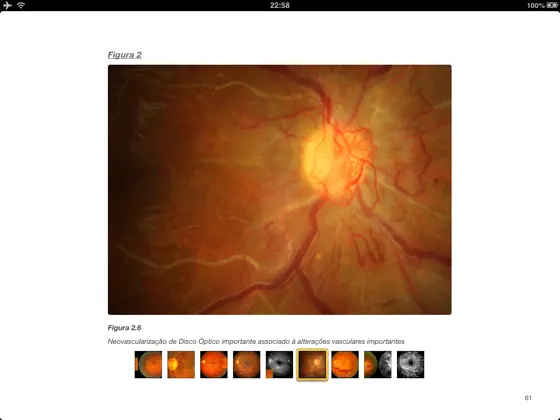 Zrzut 2 Condutas em retina - EPM / UNIFESP iphone