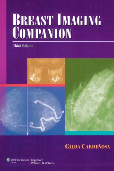 Breast Imaging Companion: Third Edition