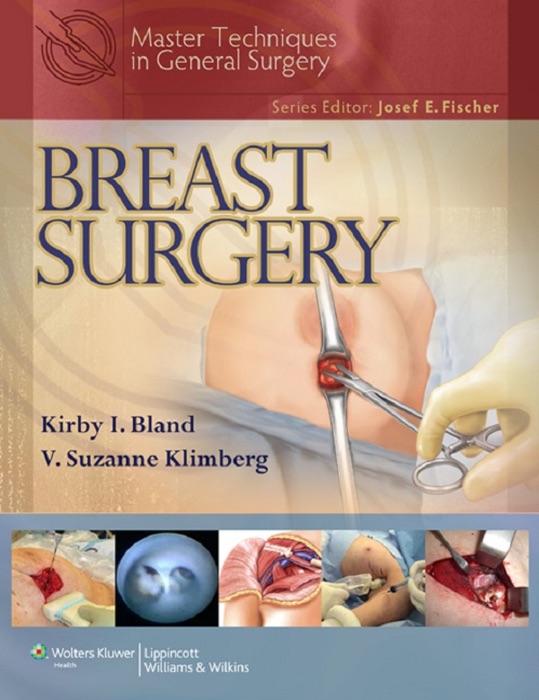 Master Techniques in General Surgery: Breast Surgery