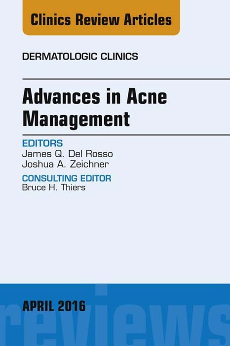 Advances in Acne Management