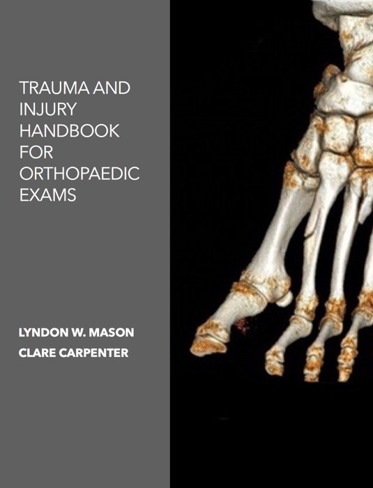 Trauma and Injury Handbook for Orthopaedic Exams