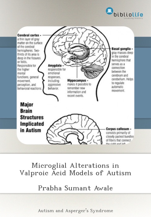 Microglial Alterations in Valproic Acid Models of Autism