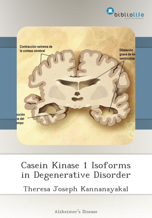 Casein Kinase 1 Isoforms in Degenerative Disorder