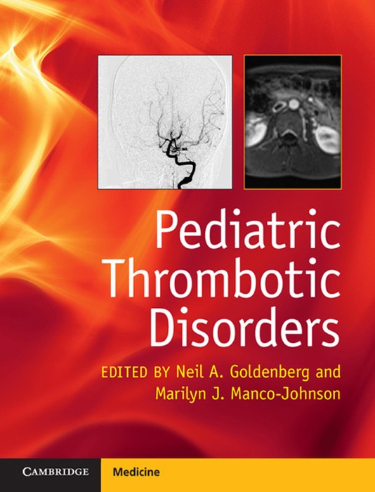 Pediatric Thrombotic Disorders