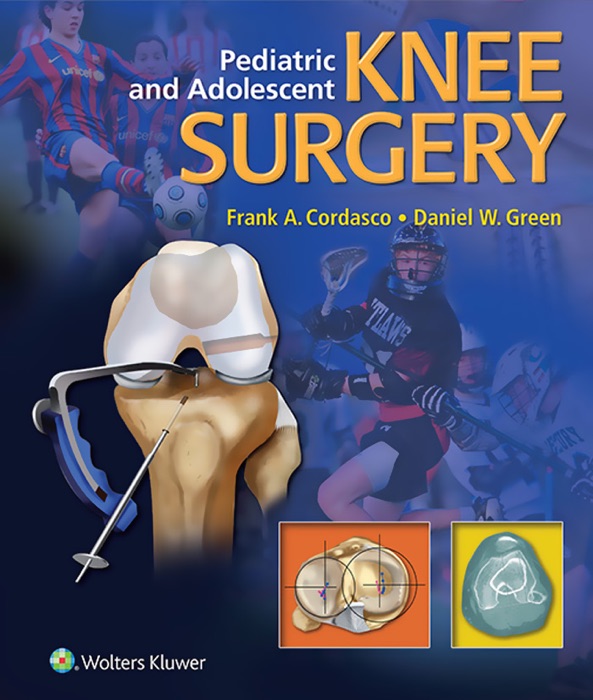 Pediatric and Adolescent Knee Surgery