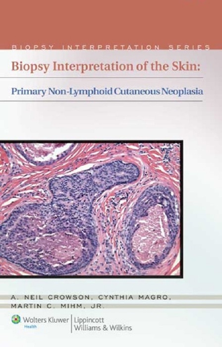 Biopsy Interpretation of the Skin