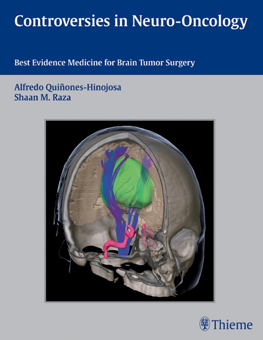 Controversies in Neuro-Oncology