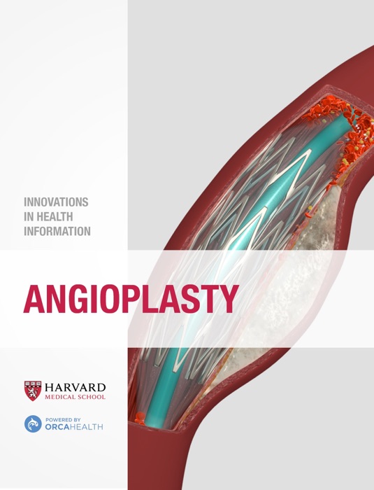 Angioplasty