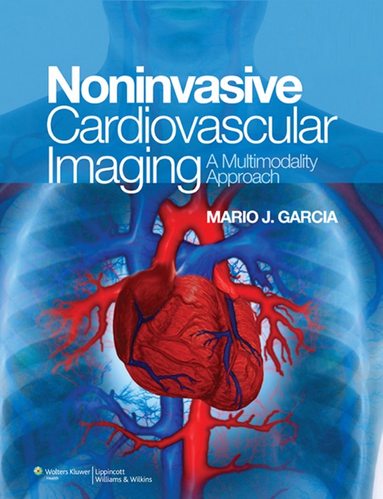 NonInvasive Cardiovascular Imaging