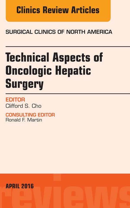 Technical Aspects of Oncological Hepatic Surgery