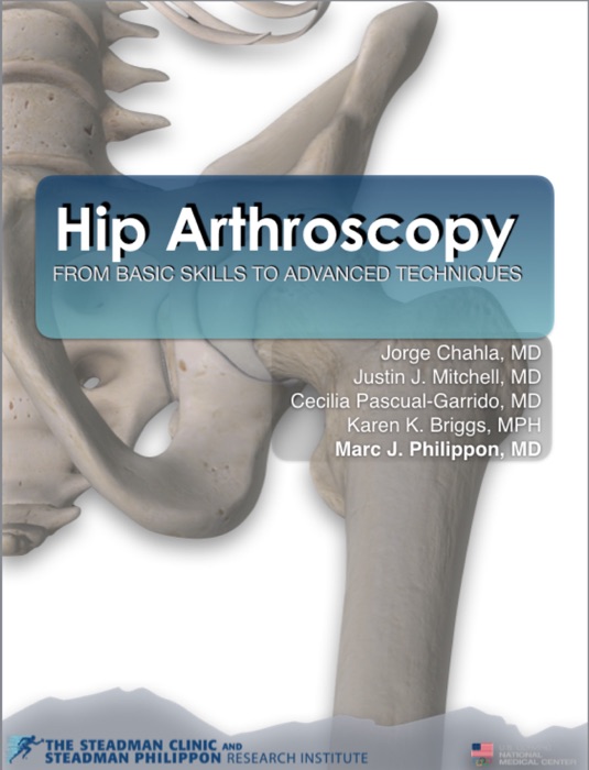 Hip Arthroscopy