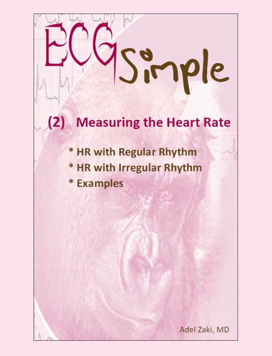 ECG-Simple (2) Measuring the Heart Rate