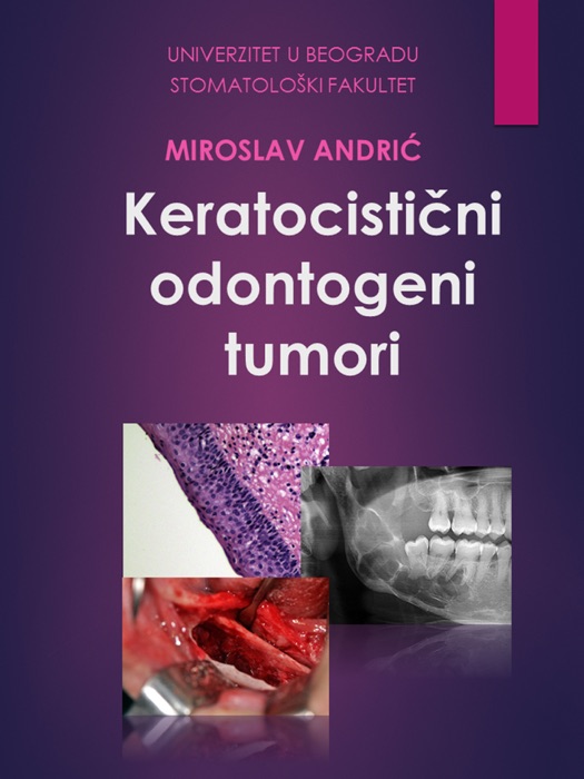 Keratocistični odontogeni tumori