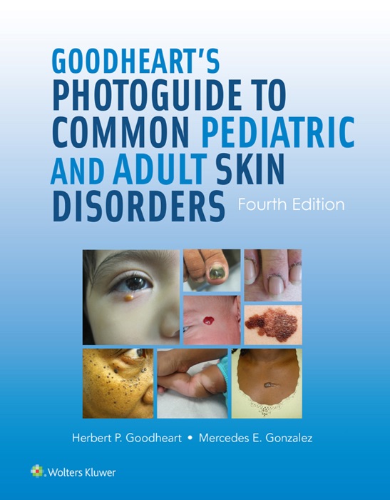 Goodheart’s Photoguide to Common Pediatric and Adult Skin Disorders: Fourth Edition