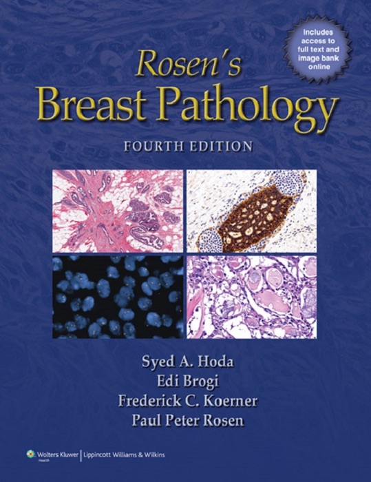 Rosen’s Breast Pathology: Fourth Edition