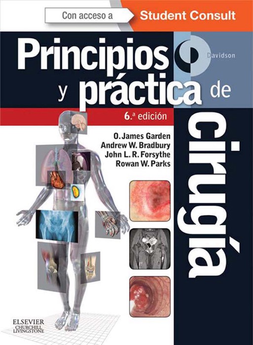 Davidson. Principios y práctica de cirugía