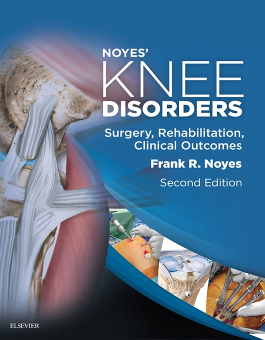 Noyes' Knee Disorders: Surgery, Rehabilitation, Clinical Outcomes E-Book