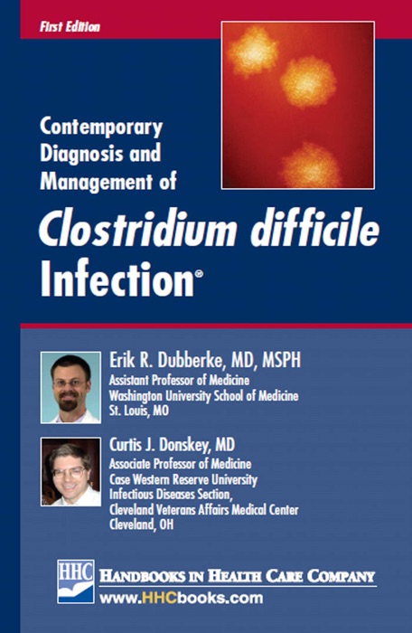 Contemporary Diagnosis and Management of Clostridium difficile Infection®