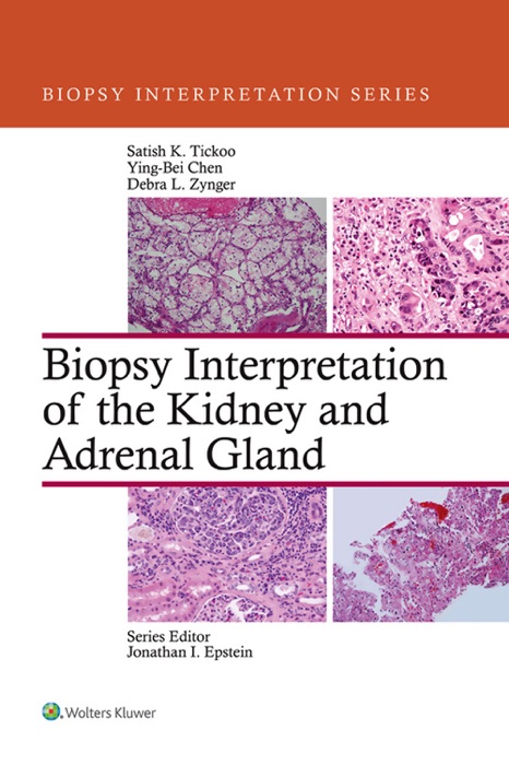 Biopsy Interpretation of the Kidney and Adrenal Gland