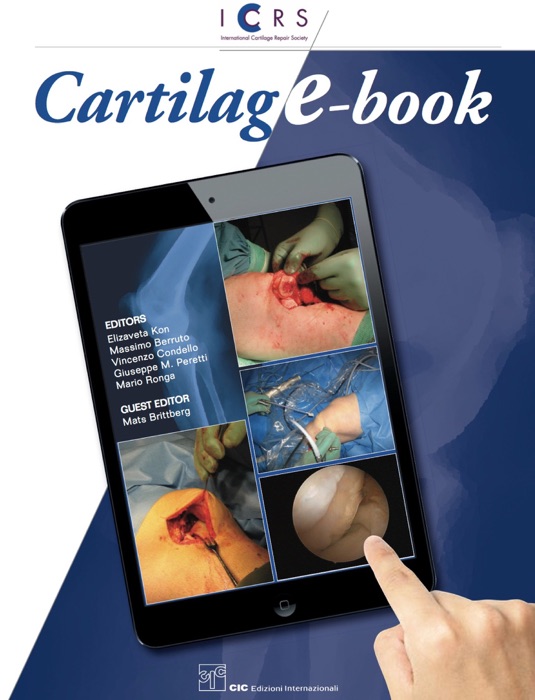 CartilagE-book