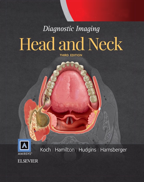 Diagnostic Imaging: Head and Neck E-Book