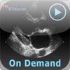 mVisum OnDemand Review