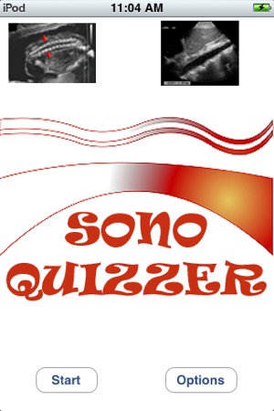 Sono Quiz Lite(圖1)-速報App