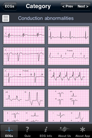 ECG Pocket Reference Belgium