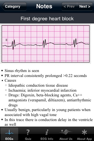 ECG Pocket Reference Belgium