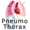 Pnuemothorax